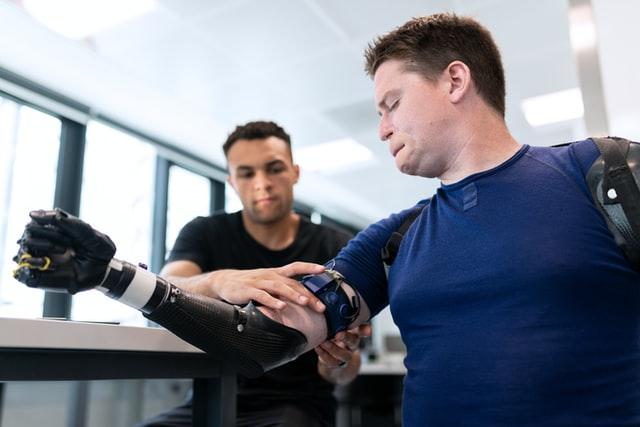 man in blue shirt trying a prosthetics arm in the right hand